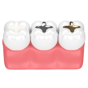 Dental Implants, Fillings - Eleven Eleven Dental